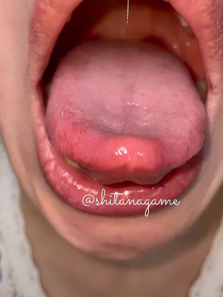 X (Twitter) adult video siipyfwxeloyrg_m
