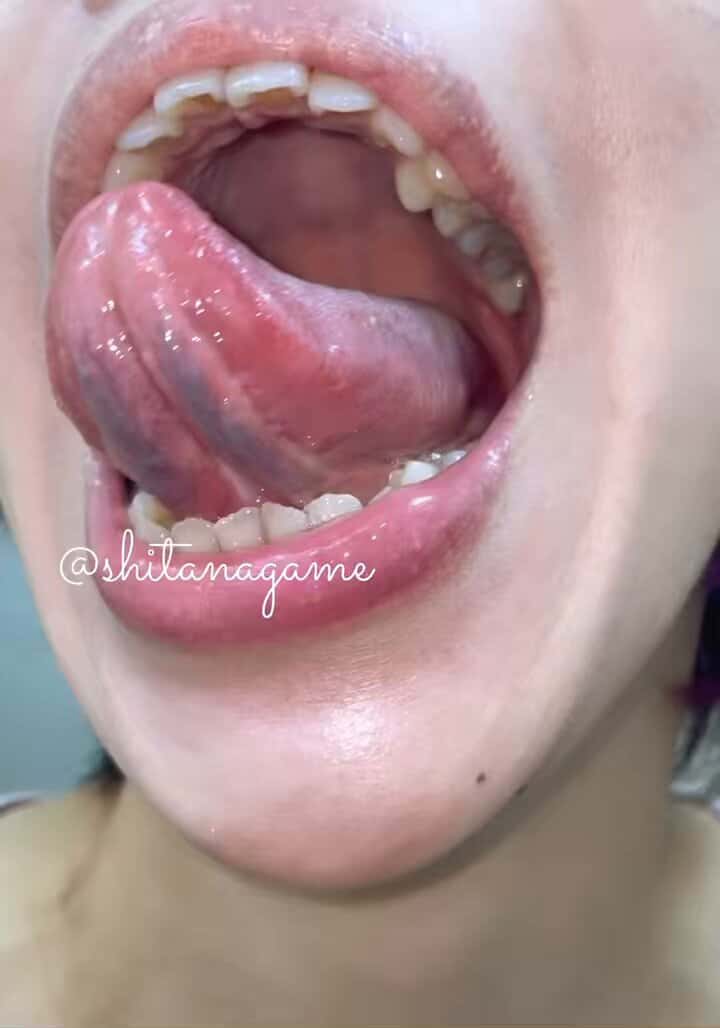 X (Twitter) adult video tsksuapvosxvtdye