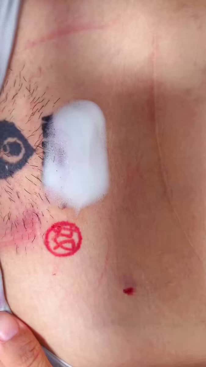 X (Twitter) adult video 3KIlVpQ5Ll1evusF
