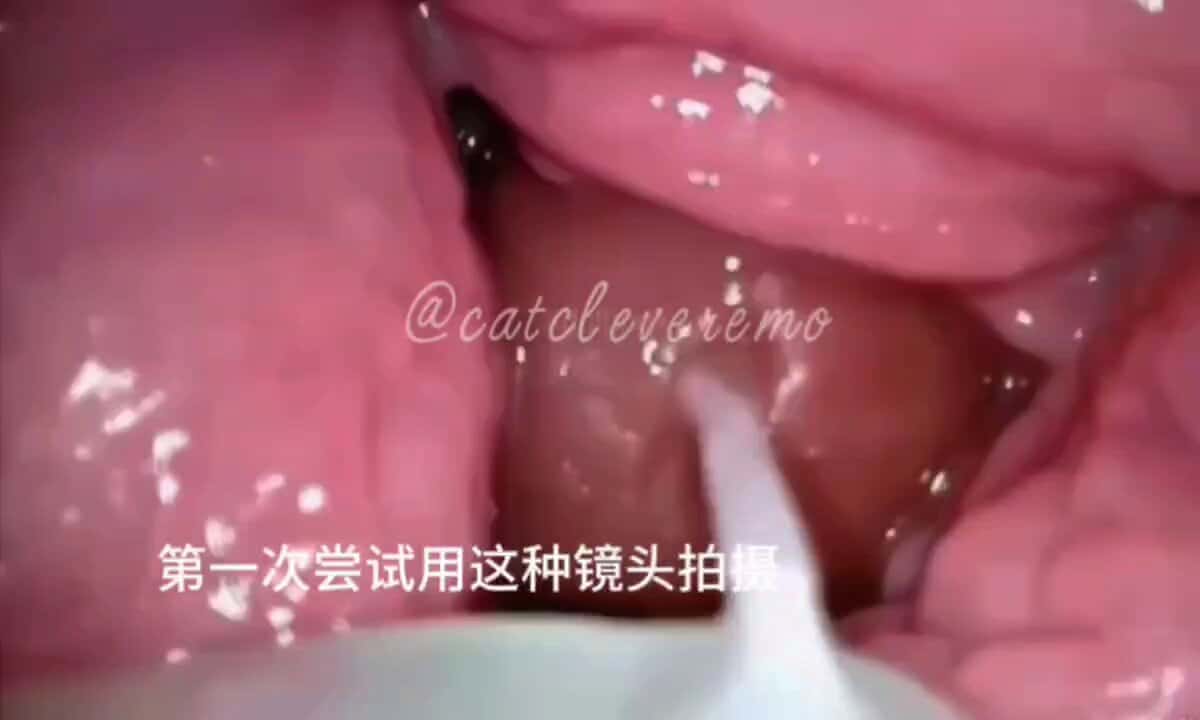X (Twitter) adult video sf8JGSx0KwMRshYb
