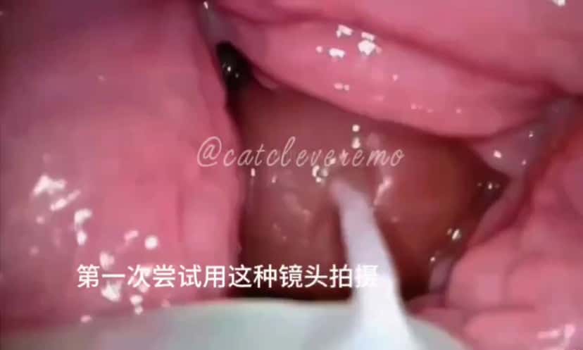 X (Twitter) adult video sf8JGSx0KwMRshYb