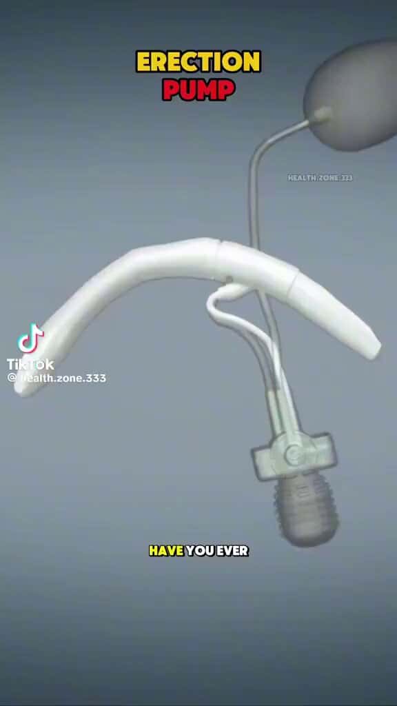 X (Twitter) adult video ZoUk9y5x1lu3d5it
