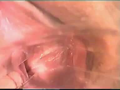 X (Twitter) adult video MABiMR6nJIgcMTrS