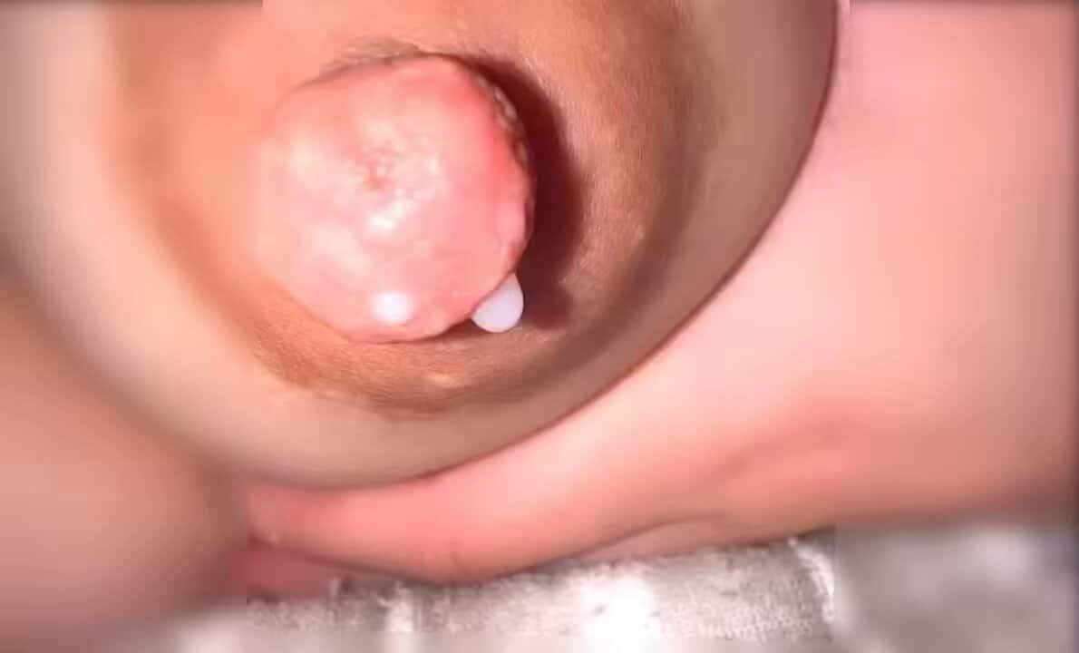 X (Twitter) adult video alqHLCU75bFvIPq-