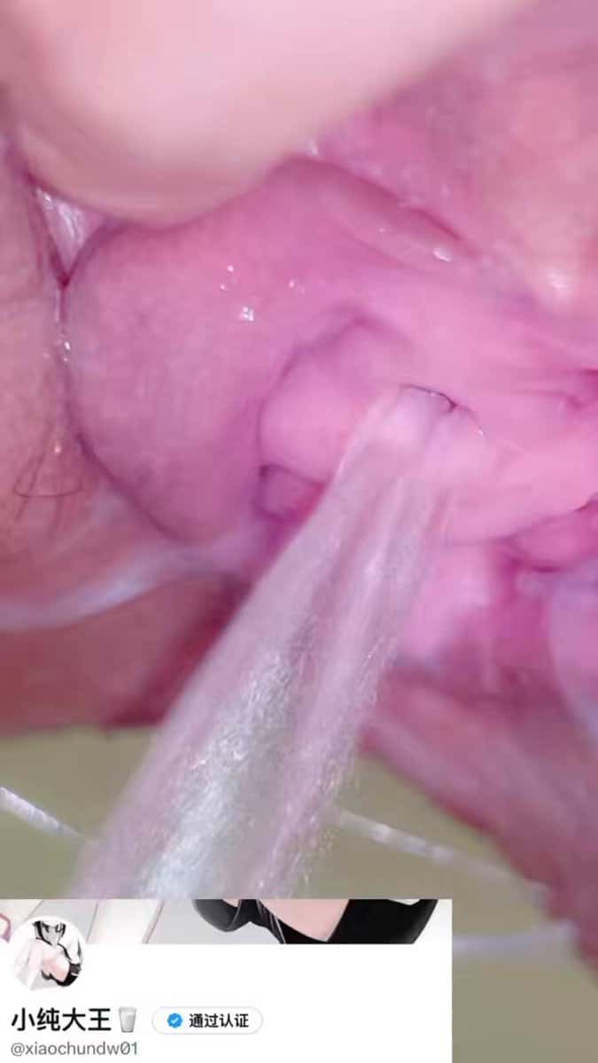 X (Twitter) adult video mXyqDn7Uc2N9A5aM