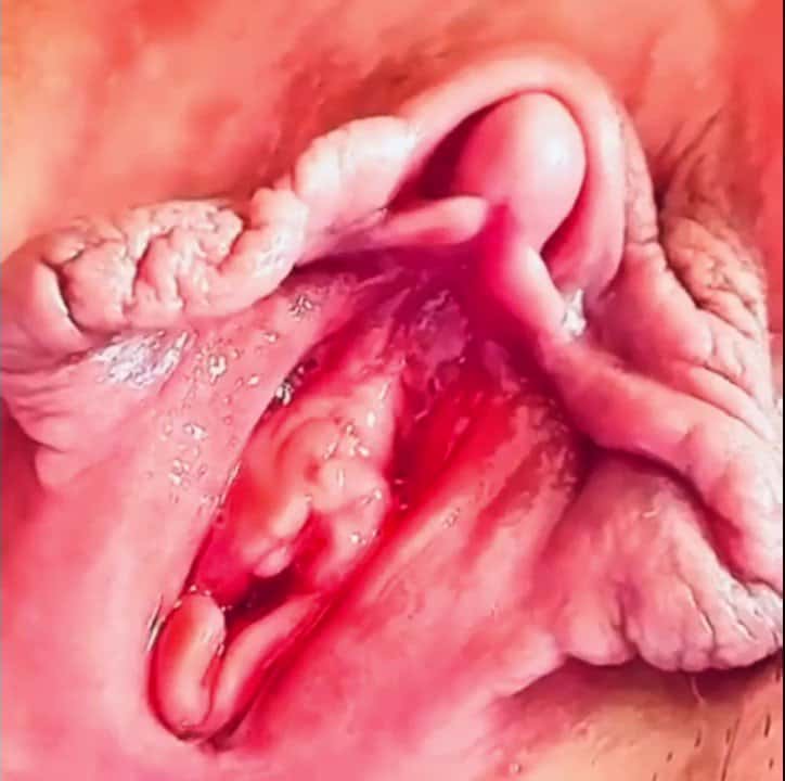 X (Twitter) adult video HfRofuKO0vdPyftd