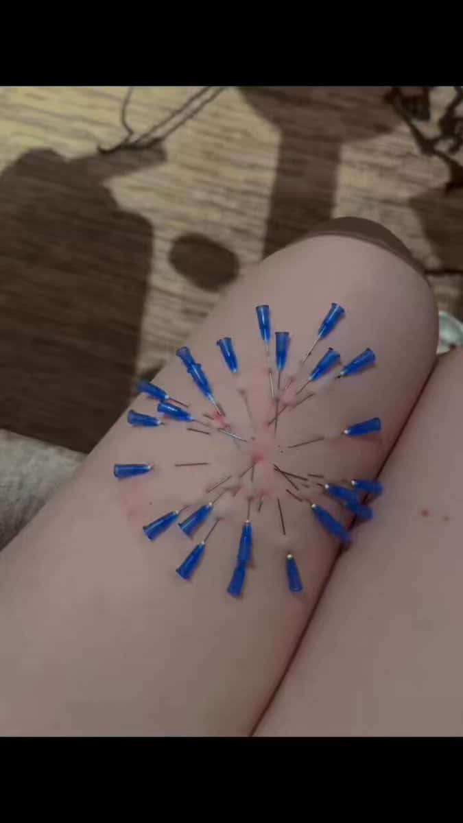 X (Twitter) adult video rVEcQjW0OR75lZAo
