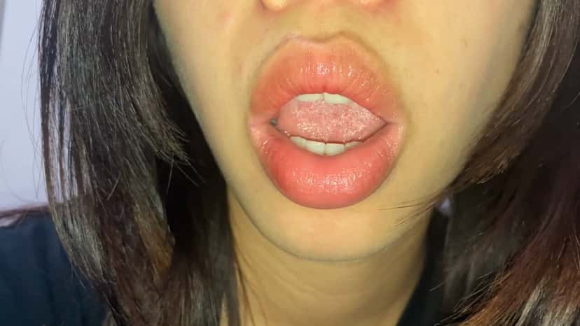 X (Twitter) adult video wk4h8swalykhkuwp