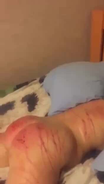X (Twitter) adult video y5zovf_5qin007ap
